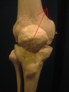 膝蓋骨　膝の皿
