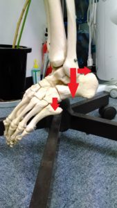 足首の関節のズレ模型