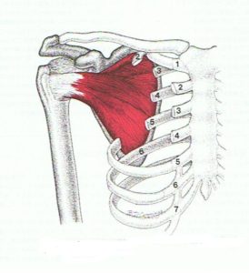 肩甲下筋　筋筋膜疼痛症候群