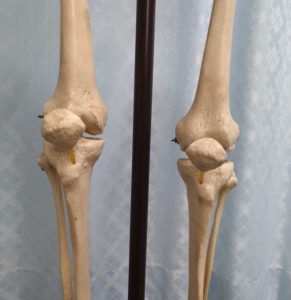 膝関節の正面像