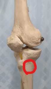 鵞足炎・膝の内側の痛み