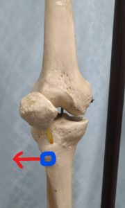 異常な膝関節