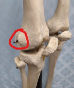 大腿骨の結節